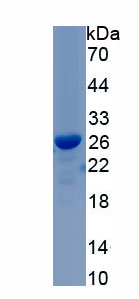 Recombinant Tryptase (TPS)