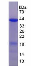 Recombinant Ubiquitin Protein Ligase E3A (UBE3A)