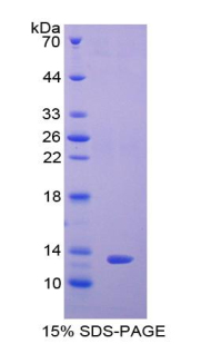 Recombinant Polymeric Immunoglobulin Receptor (PIGR)