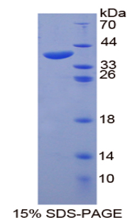 Recombinant Heat Shock 70kDa Protein 1A (HSPA1A)