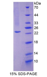 Recombinant Superoxide Dismutase 2, Mitochondrial (SOD2)