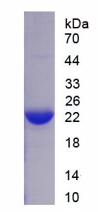 Recombinant Superoxide Dismutase 2, Mitochondrial (SOD2)