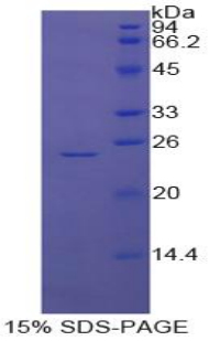 Recombinant Glutathione S Transferase Pi (GSTp)