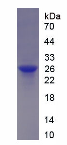 Recombinant Glutathione S Transferase Pi (GSTp)