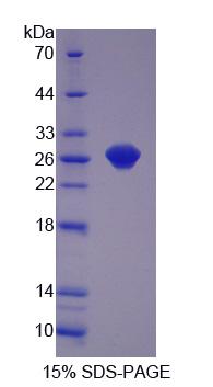 Recombinant Glutathione S Transferase Pi (GSTp)