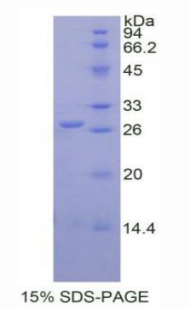 Recombinant Glutathione S Transferase Pi (GSTp)