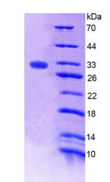 Recombinant Coagulation Factor XIII A1 Polypeptide (F13A1)