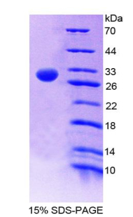 Recombinant Coagulation Factor XIII A1 Polypeptide (F13A1)