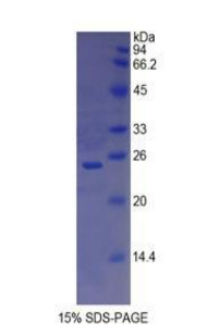 Recombinant Cluster Of Differentiation 8a (CD8a)