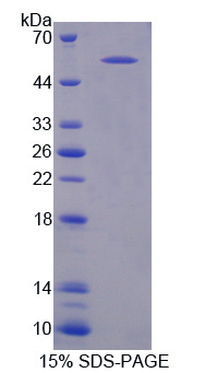 Recombinant Nucleoporin 50kDa (NUP50)