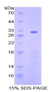 Recombinant Ectonucleoside Triphosphate Diphosphohydrolase 1 (ENTPD1)