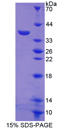 Recombinant Metallothionein 1 (MT1)