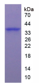 Recombinant Arginase (ARG)