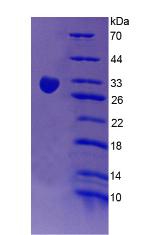 Recombinant Complement Receptor 1, Erythrocyte (CR1)