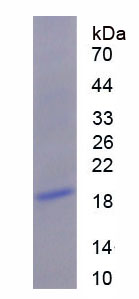 Recombinant Centromere Protein B (CENPB)