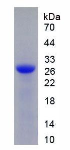 Recombinant Deoxyribonuclease I (DNASE1)