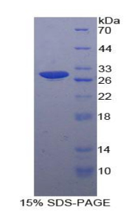 Recombinant Mitogen Activated Protein Kinase Kinase Kinase Kinase 5 (MAP4K5)
