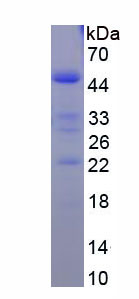 Recombinant Sialic Acid Binding Ig Like Lectin 2 (CD22)