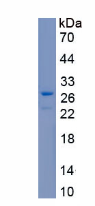 Recombinant Structural Maintenance Of Chromosomes Protein 3 (SMC3)