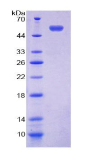 Recombinant Nucleoporin 153 (NUP153)