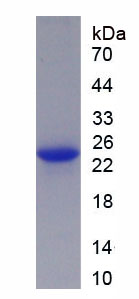 Recombinant Membrane Spanning 4 Domains Subfamily A, Member 1 (CD20)