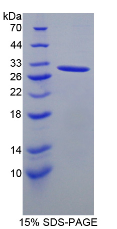 Recombinant Signaling Lymphocytic Activation Molecule Family, Member 5 (SLAMF5)