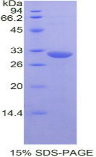 Recombinant c-Jun N-terminal Kinase 1 (JNK1)