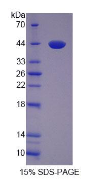 Recombinant VGF Nerve Growth Factor Inducible (VGF)