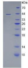 Recombinant Cluster Of Differentiation 4 (CD4)