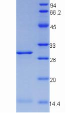 Recombinant Transferrin Receptor (TFR)