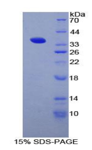 Recombinant Cluster Of Differentiation 1d (CD1d)