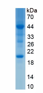 Recombinant Nucleoporin 205kDa (NUP205)