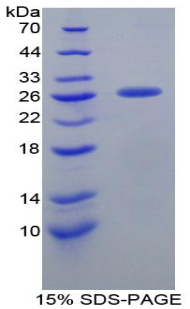 Recombinant Clusterin (CLU)
