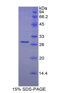 Recombinant Clusterin (CLU)