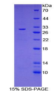 Recombinant Interleukin 27 Receptor Alpha (IL27Ra)