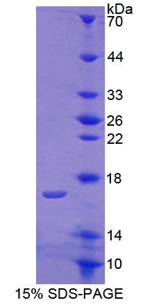 Recombinant Cartilage Oligomeric Matrix Protein (COMP)