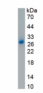 Recombinant Cartilage Oligomeric Matrix Protein (COMP)