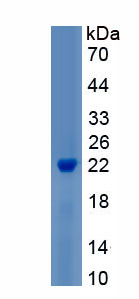 Recombinant Retinoblastoma Protein 1 (RB1)