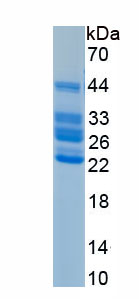 Recombinant Retinoblastoma Protein 1 (RB1)