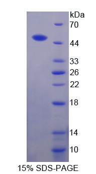 Recombinant Aspartate Aminotransferase (AST)