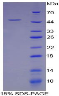 Recombinant Aspartate Aminotransferase (AST)