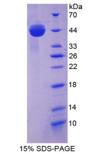 Recombinant Aspartate Aminotransferase (AST)