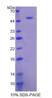 RPB215Hu01.jpg