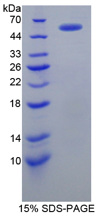 Recombinant Fibrinogen Beta Chain (FGB)