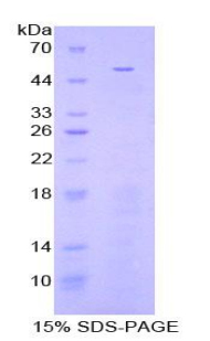 Recombinant Fibrinogen Beta Chain (FGB)