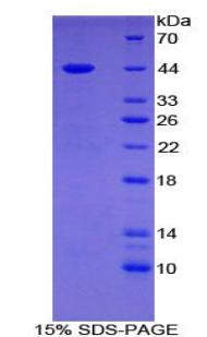 Recombinant Gastrin (GT)