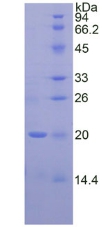 Recombinant Corticosteroid Binding Globulin (CBG)