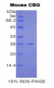 Recombinant Corticosteroid Binding Globulin (CBG)