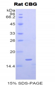 Recombinant Corticosteroid Binding Globulin (CBG)