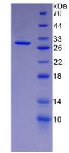 Recombinant Cytokeratin 18 (CK18)